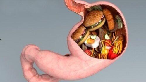 袖状胃术后吃瓜